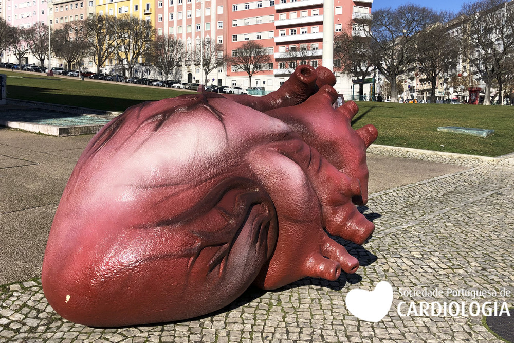 Insuficiência Cardíaca | Coração gigante